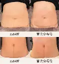 【Thermal Sculpting】_4_zh_cn.webp
