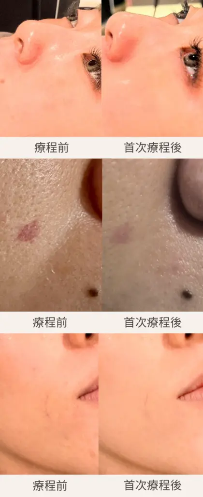 【Skin Radiance】_6_zh_cn.webp