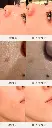 【Skin Radiance】_6_zh_cn.webp