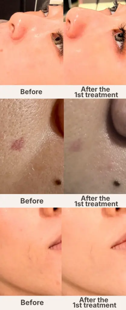 【Skin Radiance】_6_en_us.webp