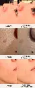【Skin Radiance】_6_en_us.webp